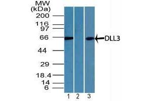 Image no. 1 for anti-delta Like Protein 3 (DLL3) (AA 100-150) antibody (ABIN960134)