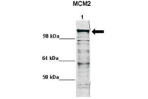 WB Suggested Anti-MCM2 Antibody    Positive Control:  Lane 1: 5ug mouse neural stem cell lysate  Primary Antibody Dilution :   1:1000  Secondary Antibody :  Anti rabbit - IR-dye  Secondry Antibody Dilution :   1:10,000   Submitted by:  Anonymous (MCM2 anticorps  (N-Term))