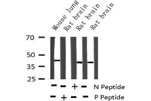 Western blot analysis of Phospho-MEK2 (Thr394) expression in various lysates