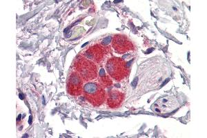 Anti-ZFP36 antibody IHC of human small intestine, submucosal plexus.
