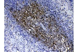 IHC analysis of CD90/Thy1 using anti- CD90/Thy1 antibody .