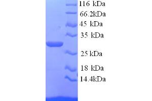 SDS-PAGE (SDS) image for Asialoglycoprotein Receptor 1 (ASGR1) (AA 61-284) protein (His tag) (ABIN5713264)