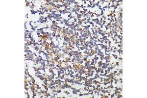 Immunohistochemistry of paraffin-embedded human colon using CSF3 antibody (ABIN6127710, ABIN6139100, ABIN6139101 and ABIN6221772) at dilution of 1:100 (40x lens).