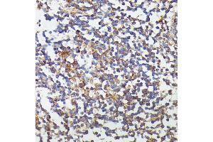 Immunohistochemistry of paraffin-embedded human colon using CSF3 antibody (ABIN6127710, ABIN6139100, ABIN6139101 and ABIN6221772) at dilution of 1:100 (40x lens). (G-CSF anticorps  (AA 30-207))