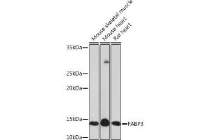 Western blot analysis of extracts of various cell lines, using F Rabbit mAb (ABIN7267152) at 1:1000 dilution.
