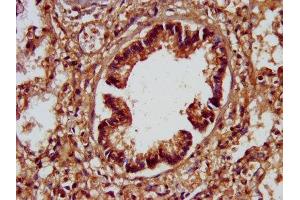 IHC image of ABIN7170440 diluted at 1:200 and staining in paraffin-embedded human lung tissue performed on a Leica BondTM system.