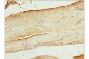 Immunohistochemistry of paraffin-embedded human skeletal muscle tissue using ABIN7175708 at dilution of 1:100 (WIPI2 anticorps  (AA 205-454))