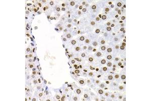Immunohistochemistry of paraffin-embedded rat liver using NFKB2 Antibody (ABIN5971590) at dilution of 1/100 (40x lens). (NFKB2 anticorps)