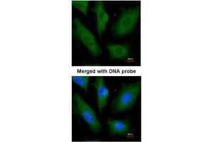ICC/IF Image Immunofluorescence analysis of paraformaldehyde-fixed HeLa, using SCY1 like 3, antibody at 1:200 dilution. (SCYL3 anticorps  (Center))