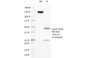 SDS-PAGE Analysis Purified HNF1A Mouse Monoclonal Antibody (HNF1A/2087).