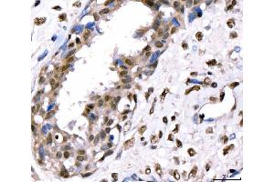 IHC analysis of CRTC3 using anti-CRTC3 antibody (ABIN7599779). (CRTC3 anticorps  (AA 116-619))