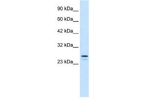 WB Suggested Anti-RNF2 Antibody Titration:  1.