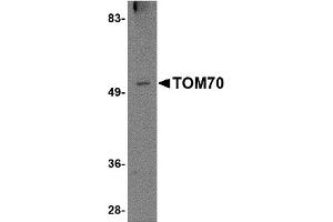 Western Blotting (WB) image for anti-Translocase of Outer Mitochondrial Membrane 70 (TOMM70A) (N-Term) antibody (ABIN1031635) (TOM70 anticorps  (N-Term))