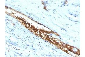 anti-ABO, Blood Group A Antigen antibody