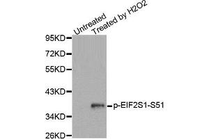 Western Blotting (WB) image for anti-Eukaryotic Translation Initiation Factor 2 Subunit 1 (EIF2S1) (pSer51) antibody (ABIN1870140) (EIF2S1 anticorps  (pSer51))