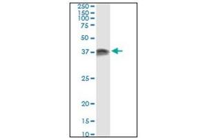 Western Blotting (WB) image for anti-Protein Kinase, Interferon-Inducible Double Stranded RNA Dependent Activator (PRKRA) antibody (ABIN781891) (PRKRA anticorps)