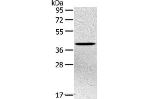 Western blot analysis of Hepg2 cell, using PTX3 Polyclonal Antibody at dilution of 1:400 (PTX3 anticorps)