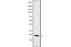 Western blot analysis of REG4 using HeLa whole cell lysates (REG4 anticorps  (Internal Region))