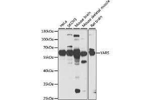 Western blot analysis of extracts of various cell lines, using YARS antibody (ABIN6128883, ABIN6150324, ABIN6150325 and ABIN6222537) at 1:1000 dilution. (YARS anticorps  (AA 1-300))