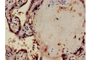 Immunohistochemistry of paraffin-embedded human placenta tissue using ABIN7169304 at dilution of 1:100 (PPP1CA anticorps  (Catalytic Subunit))