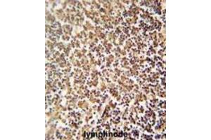 Immunohistochemistry (IHC) image for anti-Zinc Finger Protein 98 (ZNF98) antibody (ABIN2995694) (ZNF98 anticorps)