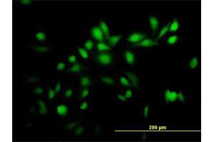 Immunofluorescence of purified MaxPab antibody to TRIM39 on HeLa cell.