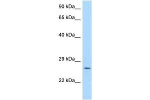 WB Suggested Anti-Ywhag Antibody Titration: 1. (14-3-3 gamma anticorps  (N-Term))