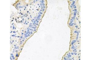 Immunohistochemistry of paraffin-embedded Mouse lung using HPR Polyclonal Antibody at dilution of 1:100 (40x lens).