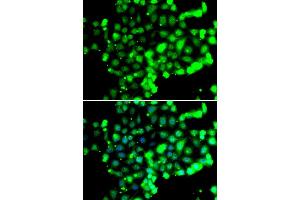 Immunofluorescence analysis of U20S cell using FASTK antibody. (FASTK anticorps)