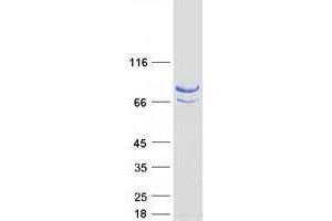 Validation with Western Blot