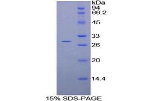 SDS-PAGE analysis of Rat vWA1 Protein.
