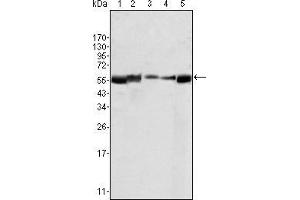 Western blot analysis using LYN mouse mAb agains HL60 (1), L540 (2), SLLP-M2 (3), SEM (4) and Ramos (5) cell lysate. (LYN anticorps)