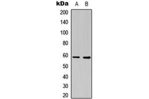 Western blot analysis of Estrogen Receptor 2 expression in COLO205 (A), NIH3T3 (B) whole cell lysates. (ESR2 anticorps  (Center))