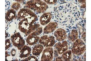 Immunohistochemistry (IHC) image for anti-Histone Deacetylase 6 (HDAC6) antibody (ABIN1498618)