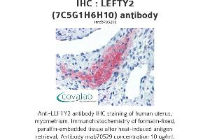 Image no. 1 for anti-Left-Right Determination Factor 2 (LEFTY2) antibody (ABIN1723390)