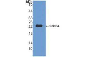 Western blot analysis of recombinant Mouse MMP12.