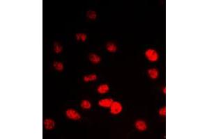 Immunofluorescent analysis of IP6K2 staining in A549 cells.
