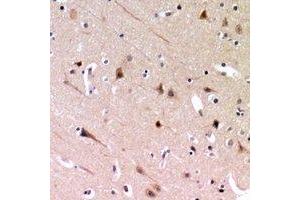 Immunohistochemical analysis of ZP2 staining in human brain formalin fixed paraffin embedded tissue section.