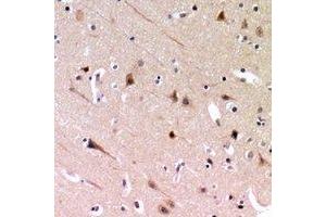 Immunohistochemical analysis of ZP2 staining in human brain formalin fixed paraffin embedded tissue section. (ZP2 anticorps)
