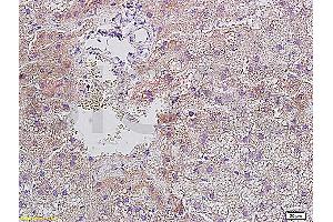 Formalin-fixed and paraffin embedded rat liver tissue with Anti-Resistin Polyclonal Antibody, Unconjugated (ABIN728278) at 1:400, followed by conjugation to the secondary antibody and DAB staining (Resistin anticorps  (AA 21-114))