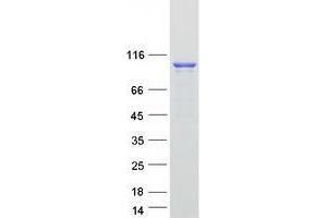 Validation with Western Blot