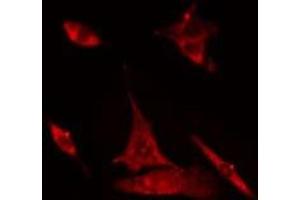 ABIN6275020 staining Hela cells by IF/ICC. (CLASP1 anticorps  (Internal Region))