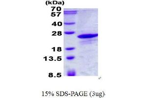 Immature Colon Carcinoma Transcript 1 (ICT1) protein (His tag)