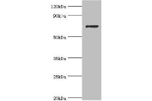 Western blot All lanes: SLC25A13 antibody at 3 μg/mL + HepG2 whole cell lysate Secondary Goat polyclonal to rabbit IgG at 1/10000 dilution Predicted band size: 74 kDa Observed band size: 74 kDa (slc25a13 anticorps  (AA 1-300))