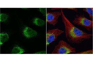 ICC/IF Image Fibrinogen gamma antibody detects Fibrinogen gamma protein at cytoplasm by immunofluorescent analysis.