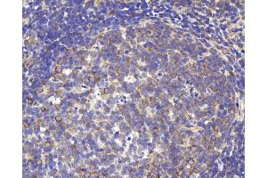 Immunohistochemistry analysis of paraffin-embedded rat lymph using CD284 Polyclonal Antibody at dilution of 1:1000. (TLR4 anticorps)