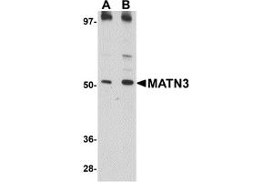 Western Blotting (WB) image for anti-Matrilin 3 (MATN3) (C-Term) antibody (ABIN1030509) (Matrilin 3 anticorps  (C-Term))