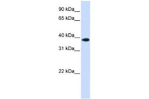WB Suggested Anti-GPD1L Antibody Titration: 0. (GPD1L anticorps  (Middle Region))