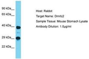 Image no. 1 for anti-DMRT-Like Family C2 (DMRTC2) (AA 280-329) antibody (ABIN6750278) (DMRTC2 anticorps  (AA 280-329))