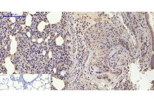 Immunohistochemistry of paraffin-embedded Rat lung tissue using BMP2 Polyclonal Antibody at dilution of 1:200. (BMP2 anticorps)